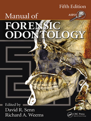 cover image of Manual of Forensic Odontology